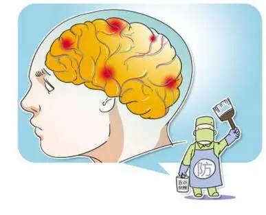 脑卒中的症状和治疗方法 脑卒中的症状和治疗方法